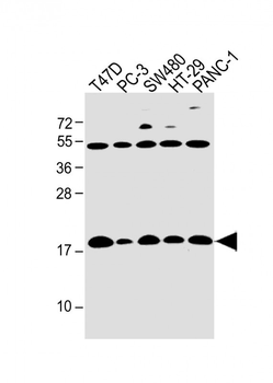 IFITM5 Antibody (Center)