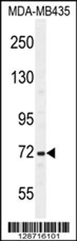 SRBD1 Antibody (C-term)