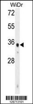 WDR5B Antibody (N-term)