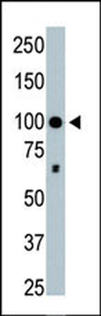 HDAC4 Antibody (C-term)