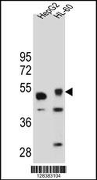 TIGD3 Antibody (C-term)