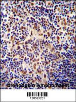 TIGD3 Antibody (C-term)