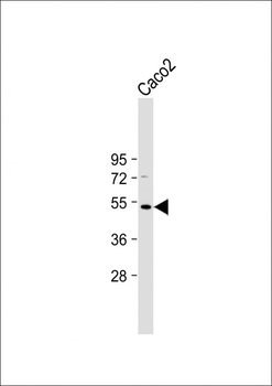 OTUD3 Antibody (Center)