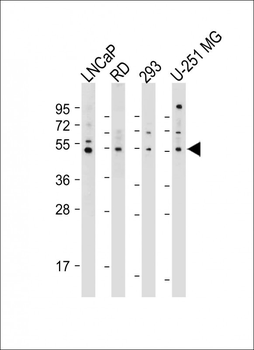 OTUD3 Antibody (Center)
