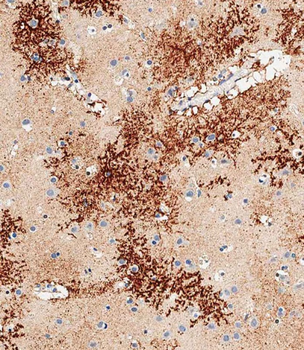 OTUD3 Antibody (Center)