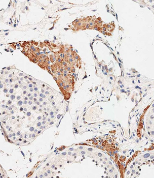 OTUD3 Antibody (Center)