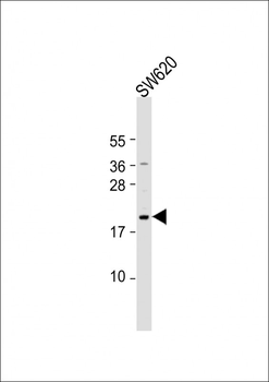 NUDT15 Antibody (C-term)