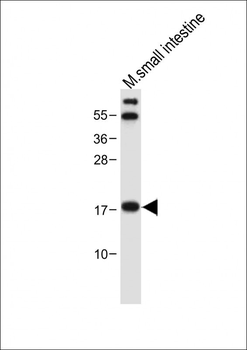 NUDT15 Antibody (C-term)