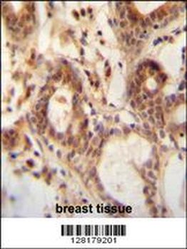 NUDT15 Antibody (C-term)