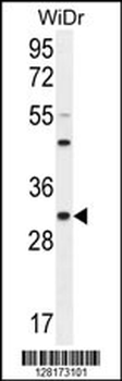 RILPL2 Antibody (Center)