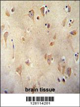 LRC40 Antibody (C-term)