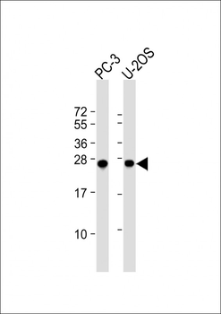 ZCCHC17 Antibody (Center)