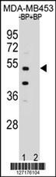 WDR51B Antibody (C-term)