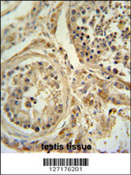 WDR51B Antibody (C-term)