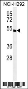 ABHD8 Antibody (C-term)