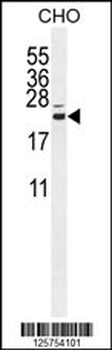 CP013 Antibody (N-term)