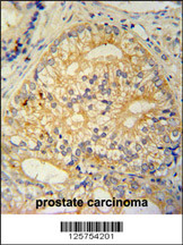 CP013 Antibody (N-term)