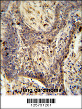 PPRC1 Antibody (C-term)