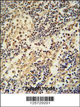 HEMK1 Antibody (C-term)