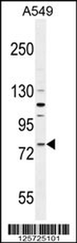FZD6 Antibody (Center)