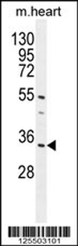 CR025 Antibody (Center)