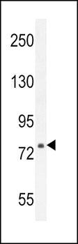 ASAP3 Antibody (N-term)