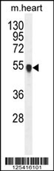 PPM1L Antibody (C-term)