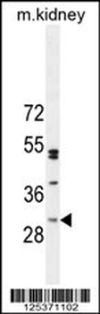 CF062 Antibody (Center)