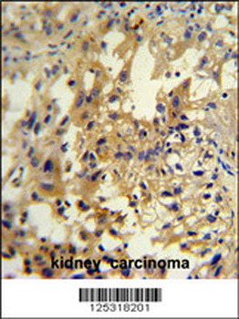 UPP2 Antibody (C-term)