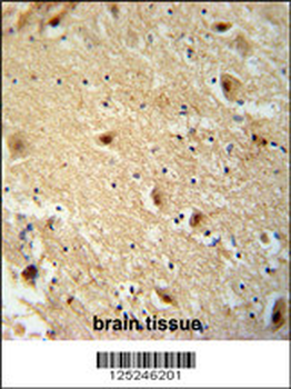 TBC14 Antibody (Center)
