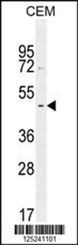 GDPD5 Antibody (center)
