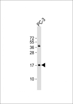 NDUF3 Antibody (N-term)