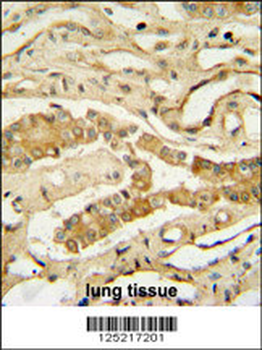 NDUF3 Antibody (N-term)