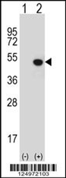 JMJD5 Antibody (N-term)