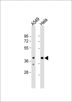 JMJD5 Antibody (N-term)