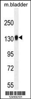 TDRD7 Antibody (C-term)