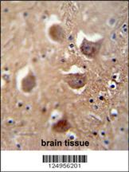 TDRD7 Antibody (C-term)