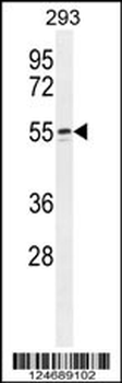 WIPF2 Antibody (C-term)