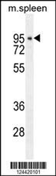 DTL Antibody (Center)