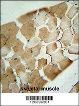 CDKN2C Antibody (C-term)