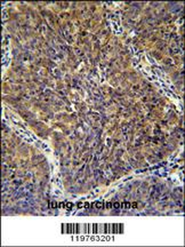 CD2BP2 Antibody (N-term)