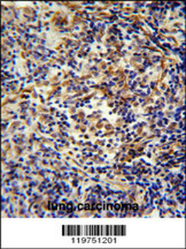 CASKIN2 Antibody (Center)