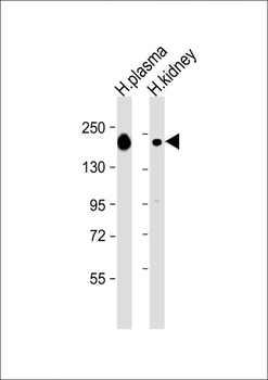 CFH Antibody (Center)