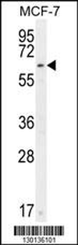 CTDSPL2 Antibody (N-term)