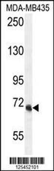 VPS52 Antibody (C-term)