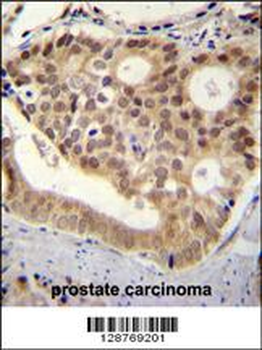 POU2AF2 Antibody (C-term)