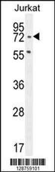 SLFN12L Antibody (N-term)