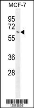 NKPD1 Antibody (C-term)