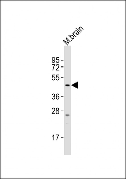 SLC16A11 Antibody (N-term)