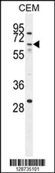ZNF674 Antibody (N-term)